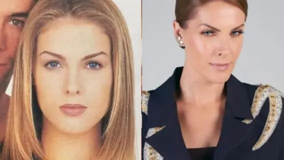 Ana Hickmann antes e depois: veja a ex-modelo no começo da carreira