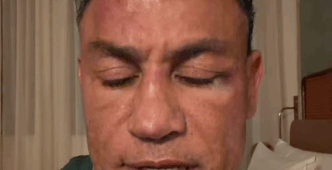 quem agrediu Wanderlei Silva Popó
