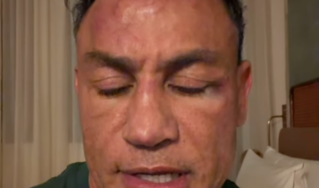 quem agrediu Wanderlei Silva Popó