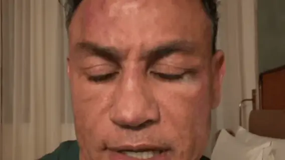 VÍDEO: quem agrediu Wanderlei Silva em luta com Popó?