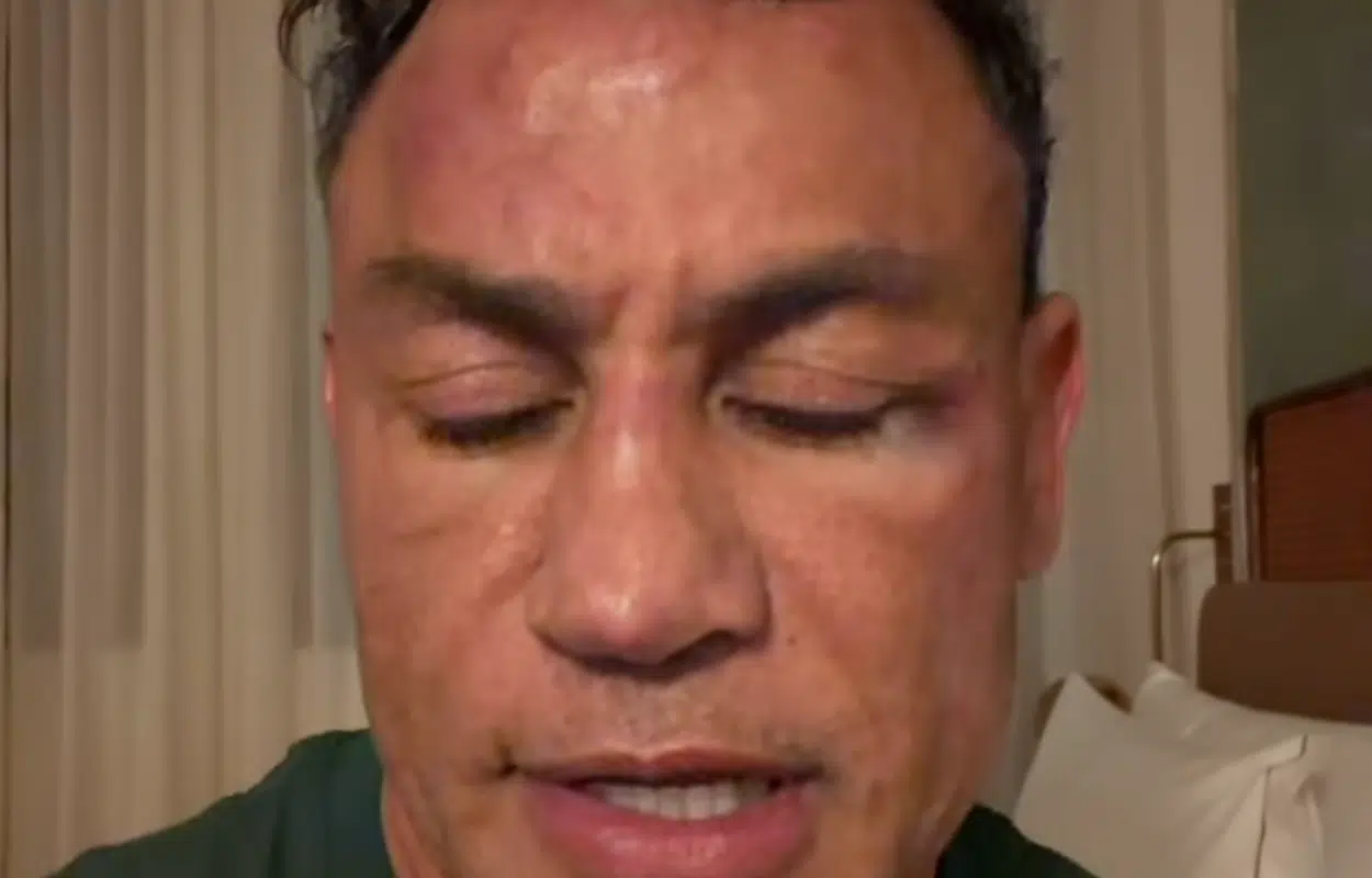 quem agrediu Wanderlei Silva Popó